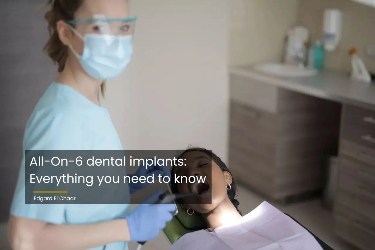 All-On-6 dental implants
