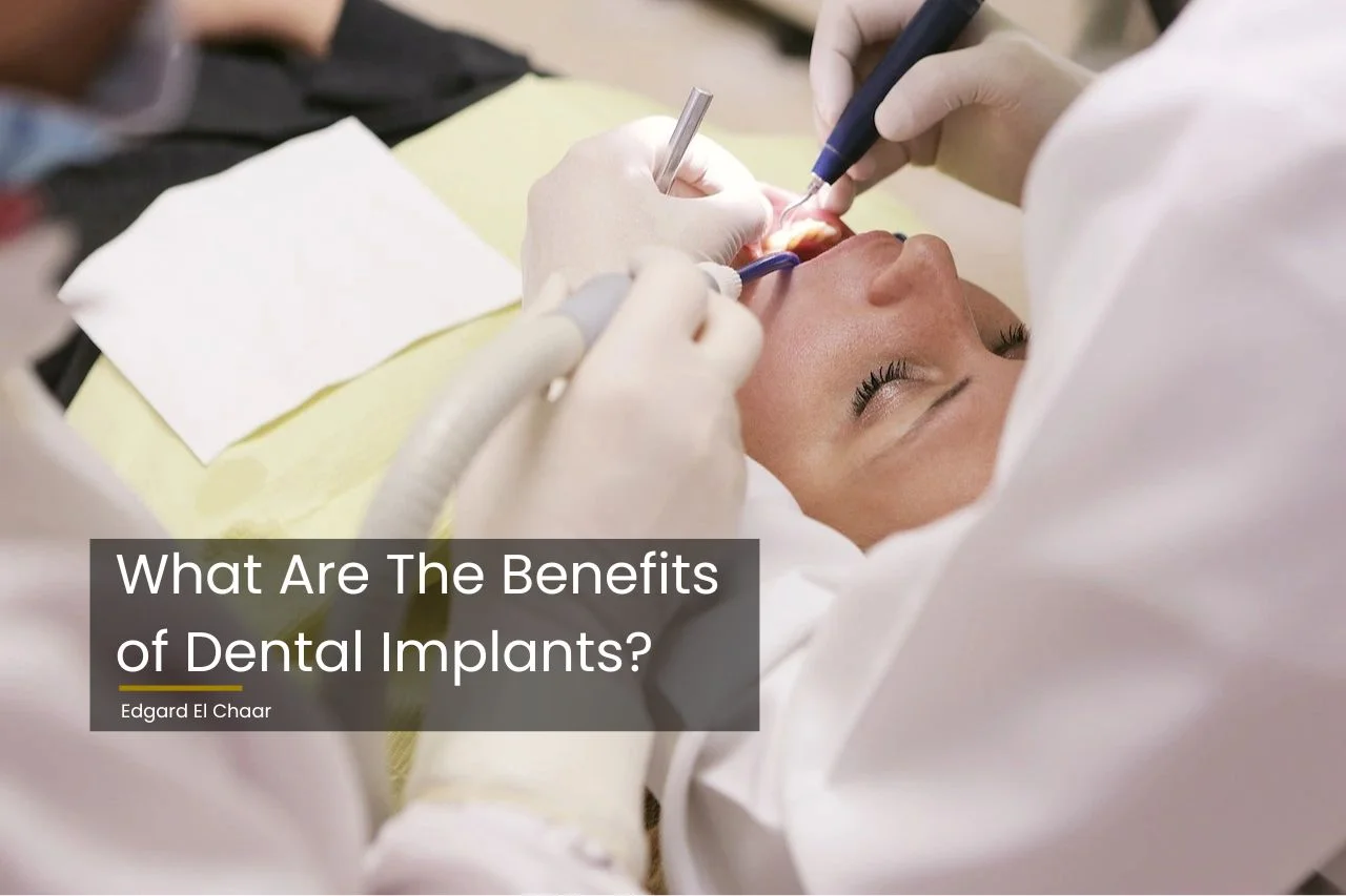 What are the benefits of dental implants