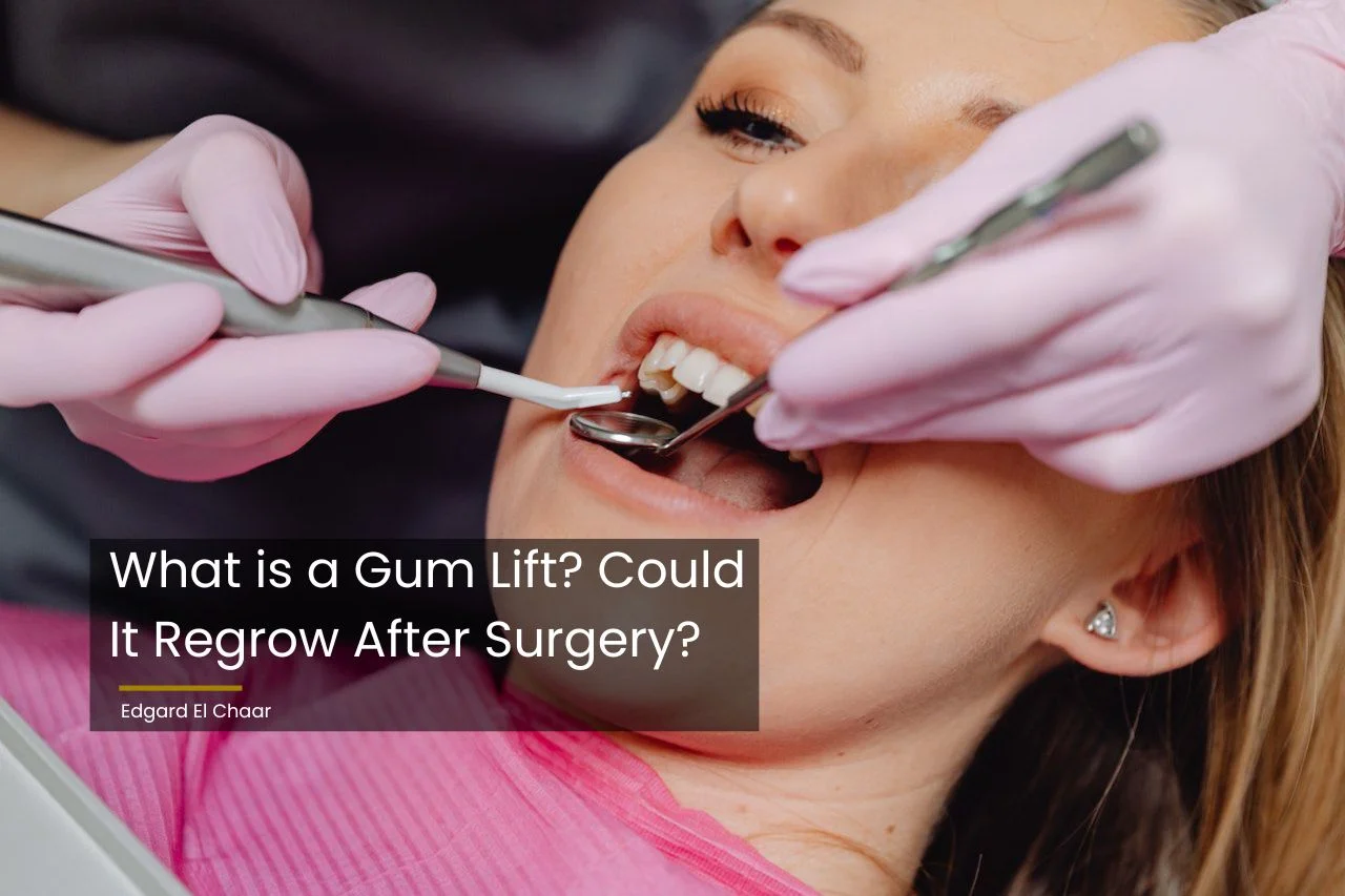What is a Gum Lift Could It Regrow After Surgery