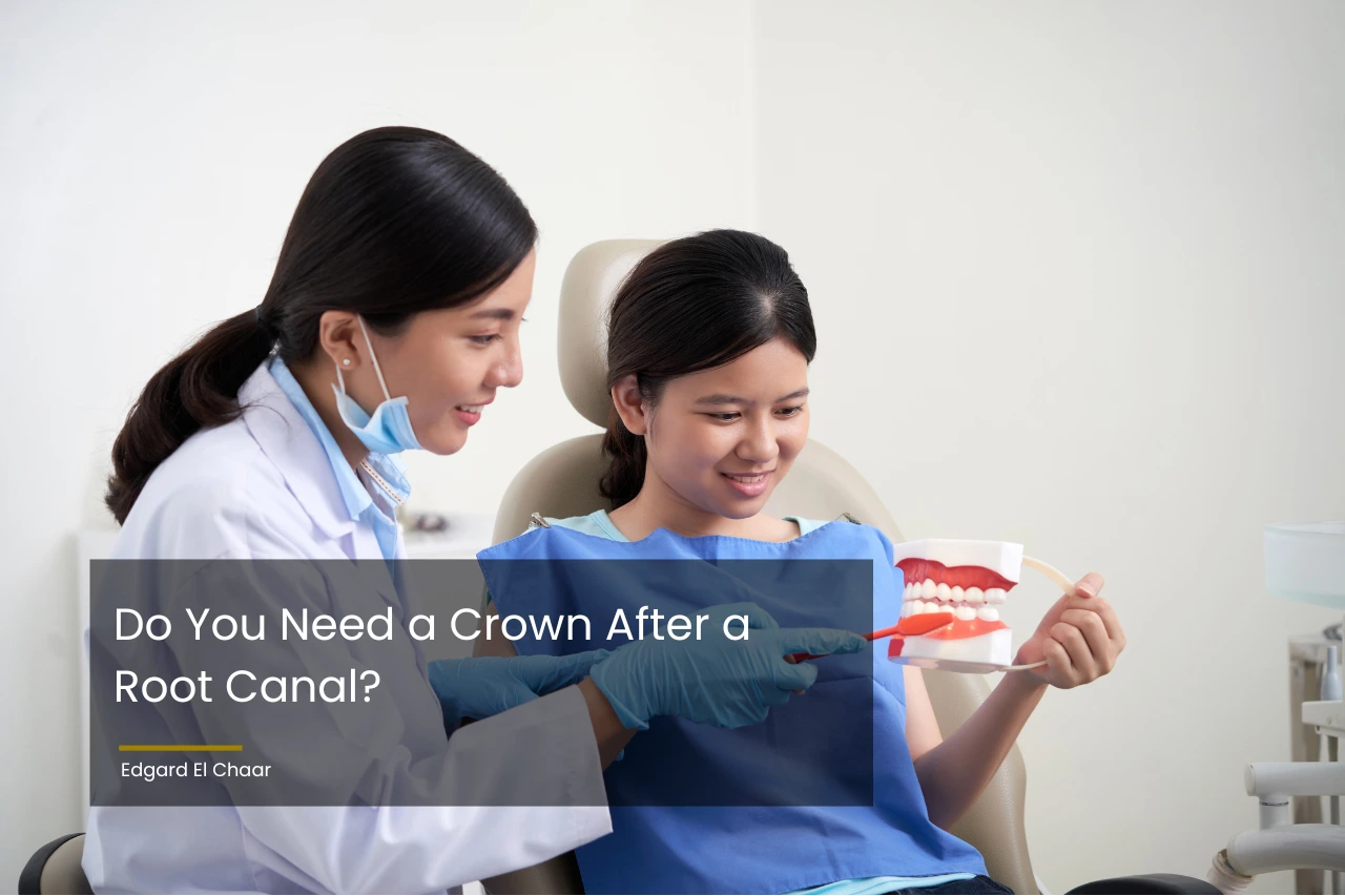 do-you-need-a-crown-after-a-root-canal