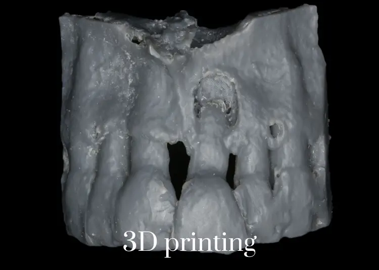 CBCT_ digital radiography (4)