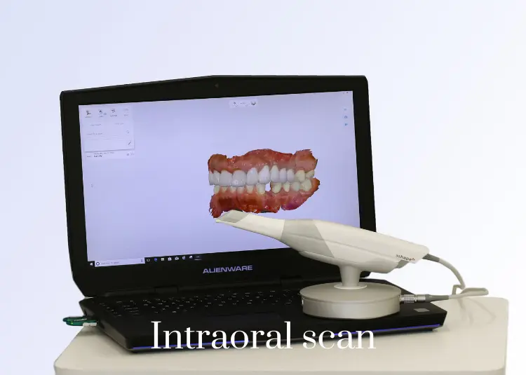 CBCT_ digital radiography (5)