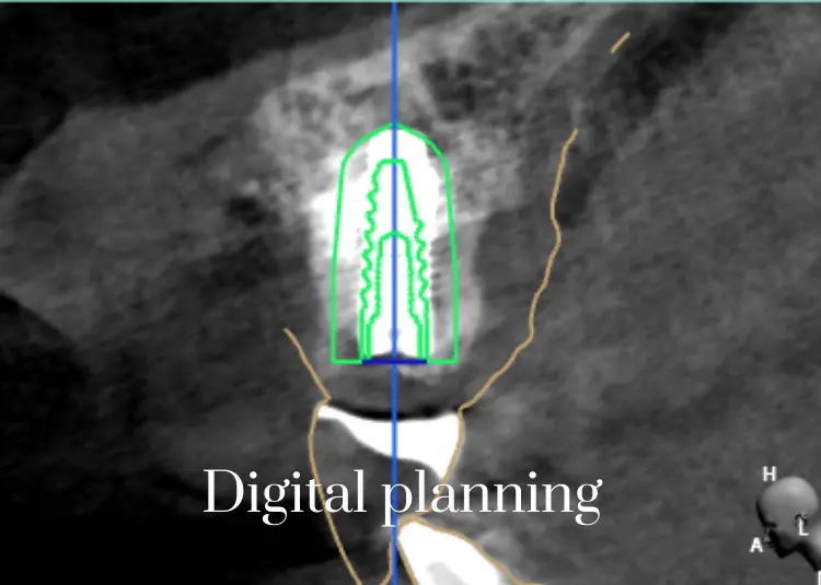 CBCT_ digital radiography (6)