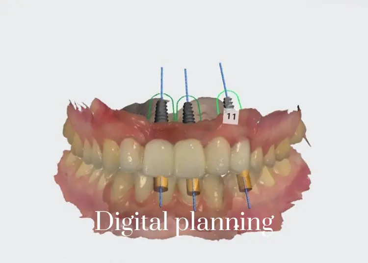 CBCT_ digital radiography (7)