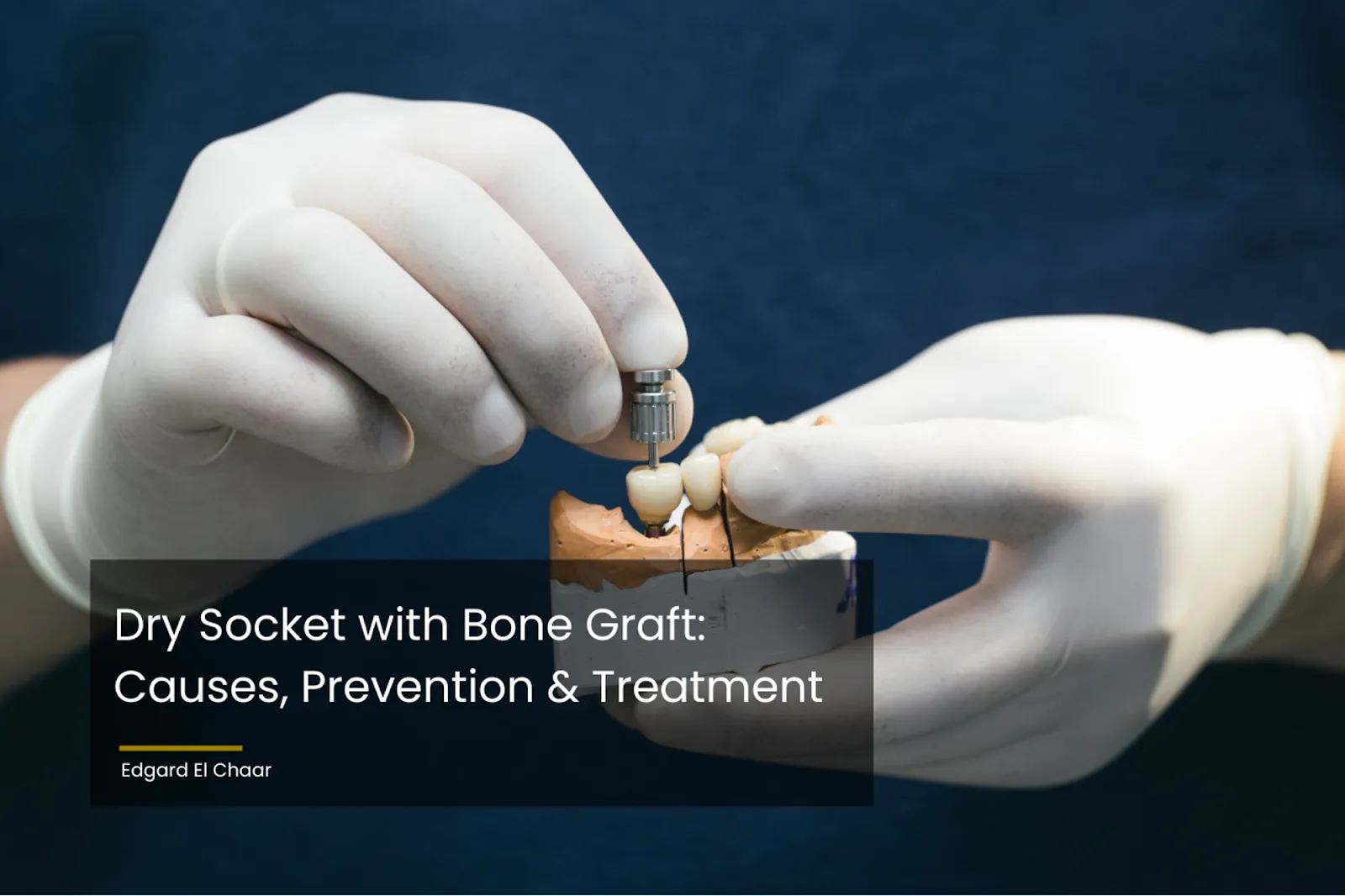 Dry Socket with Bone Graft