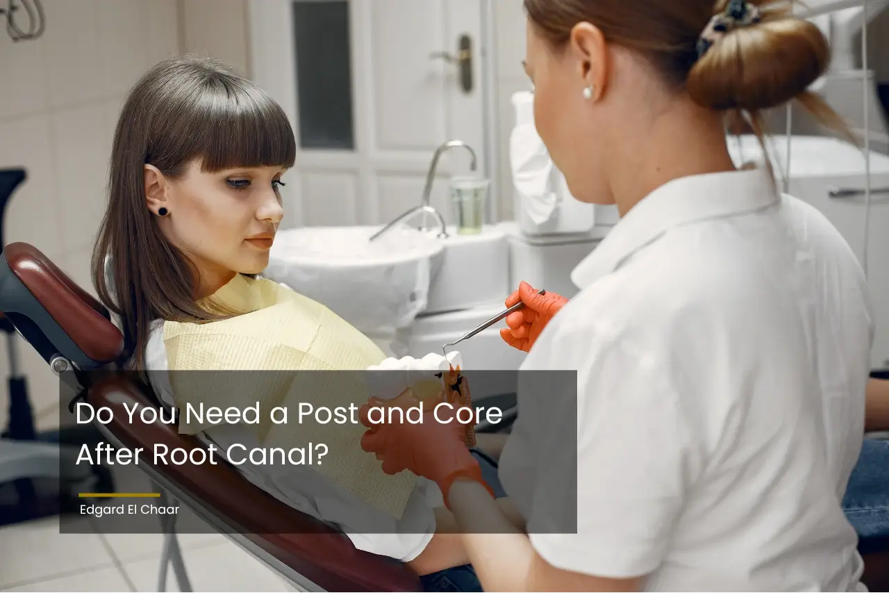 do-you-need-a-post-and-core-after-root-canal