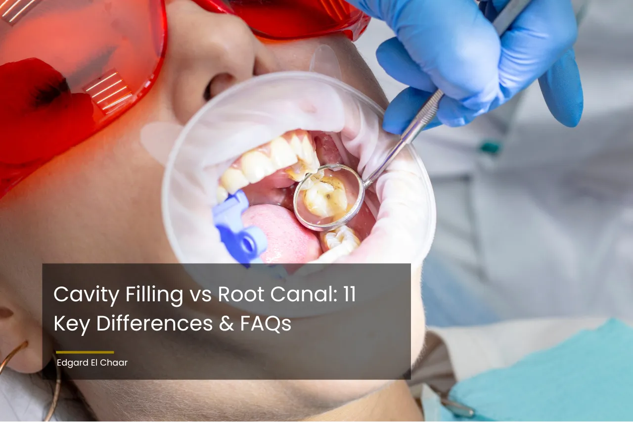 Cavity Filling vs Root Canal