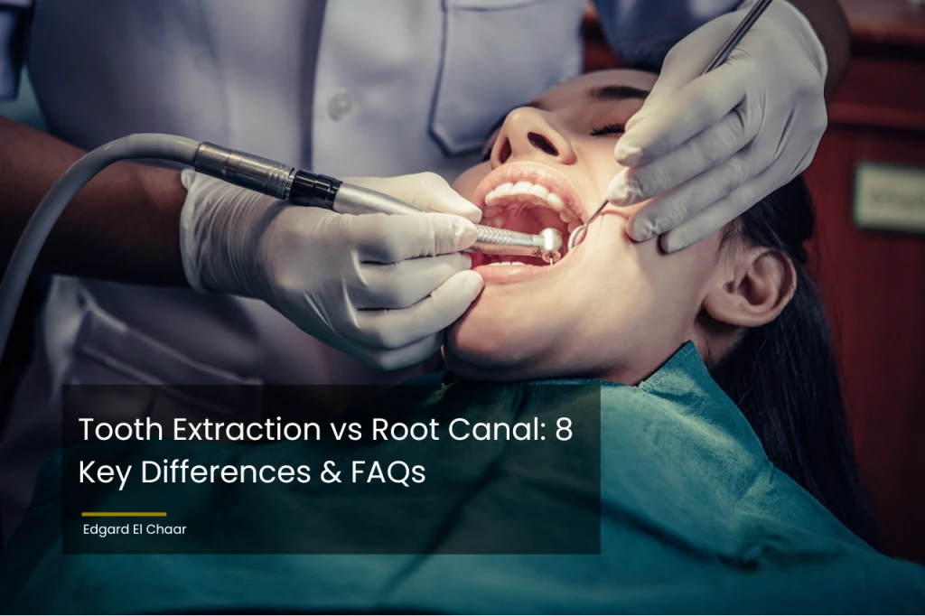 Tooth Extraction vs Root Canal