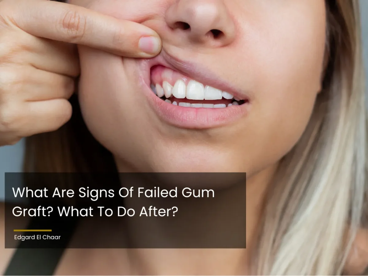 Gingival Graft Failure