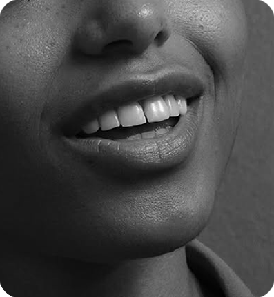 SDS Ceramic Implants